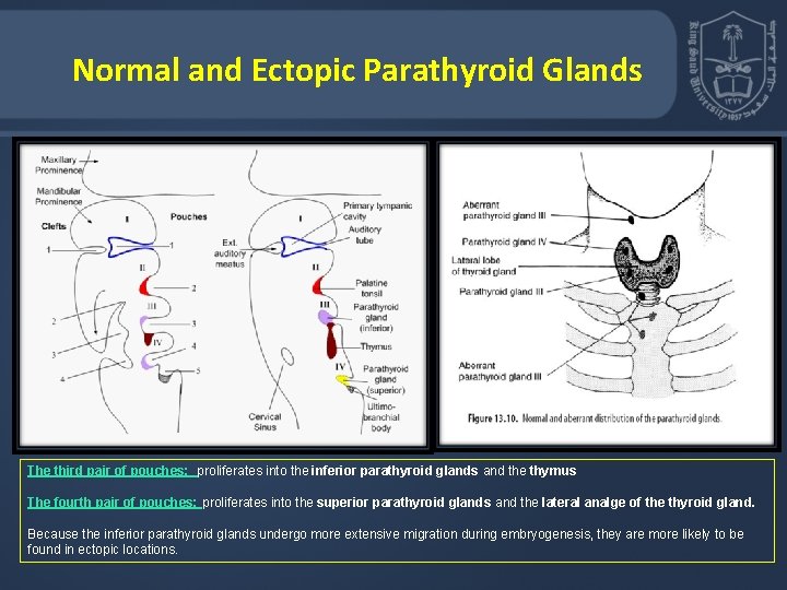 Normal and Ectopic Parathyroid Glands The third pair of pouches: proliferates into the inferior