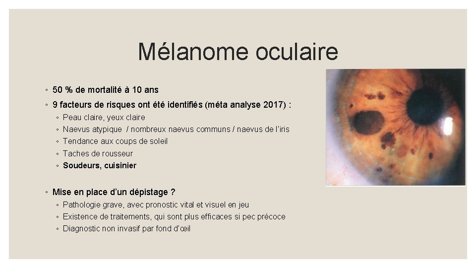 Mélanome oculaire ◦ 50 % de mortalité à 10 ans ◦ 9 facteurs de