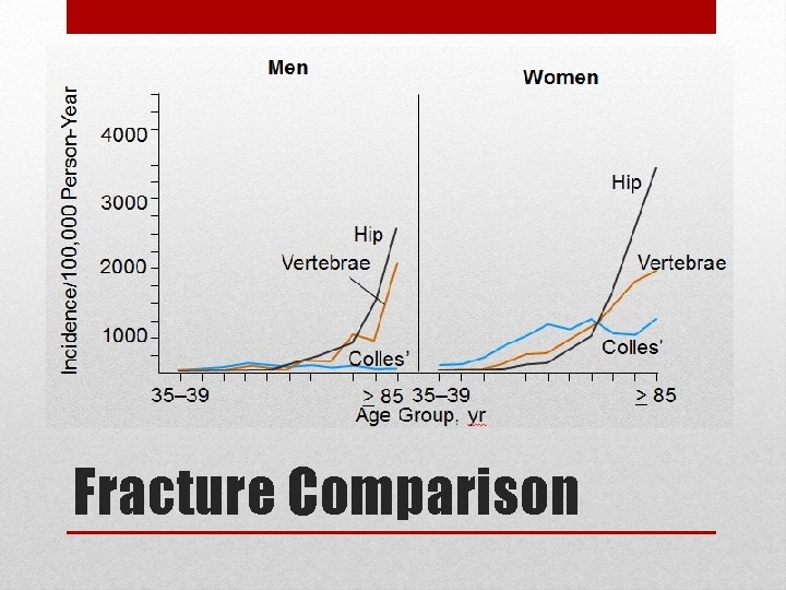 Fracture Comparison 