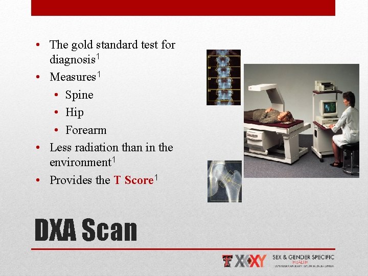  • The gold standard test for diagnosis 1 • Measures 1 • Spine