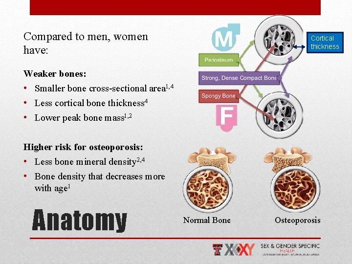 Compared to men, women have: Cortical thickness Weaker bones: • Smaller bone cross-sectional area