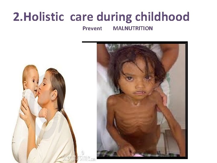 2. Holistic care during childhood Prevent MALNUTRITION 