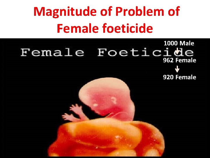 Magnitude of Problem of Female foeticide 1000 Male 962 Female 920 Female 