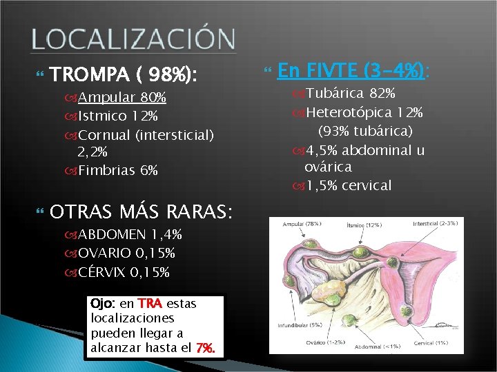  TROMPA ( 98%): Ampular 80% Istmico 12% Cornual (intersticial) 2, 2% Fimbrias 6%