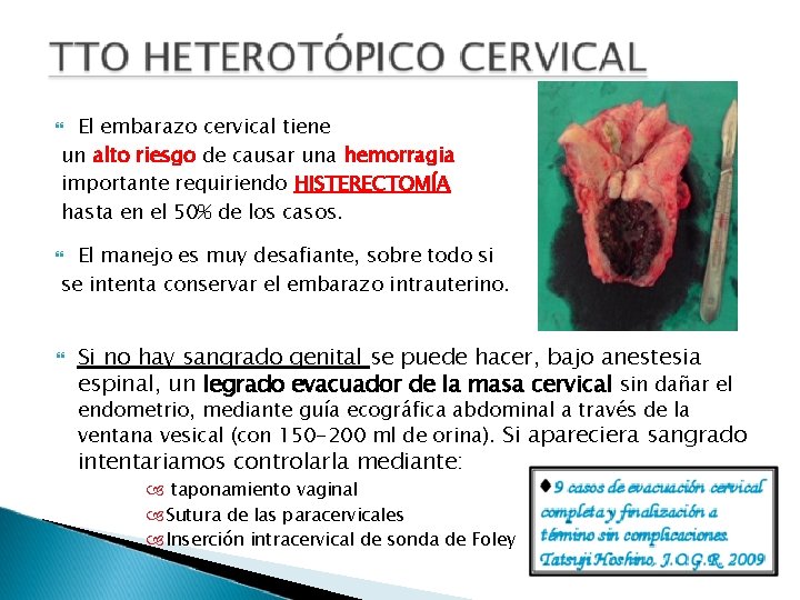 El embarazo cervical tiene un alto riesgo de causar una hemorragia importante requiriendo HISTERECTOMÍA