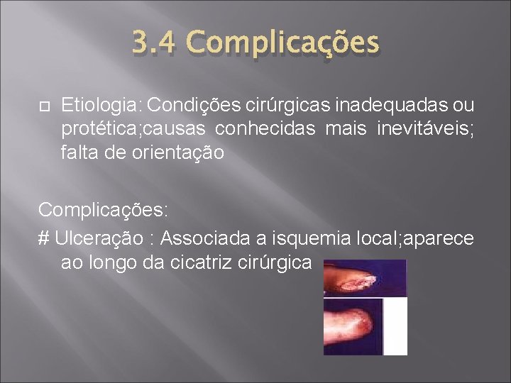 3. 4 Complicações Etiologia: Condições cirúrgicas inadequadas ou protética; causas conhecidas mais inevitáveis; falta