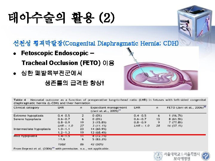 태아수술의 활용 (2) 선천성 횡격막탈장(Congenital Diaphragmatic Hernia; CDH) l Fetoscopic Endoscopic – Tracheal Occlusion