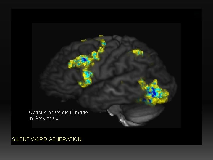 Opaque anatomical Image In Grey scale SILENT WORD GENERATION 