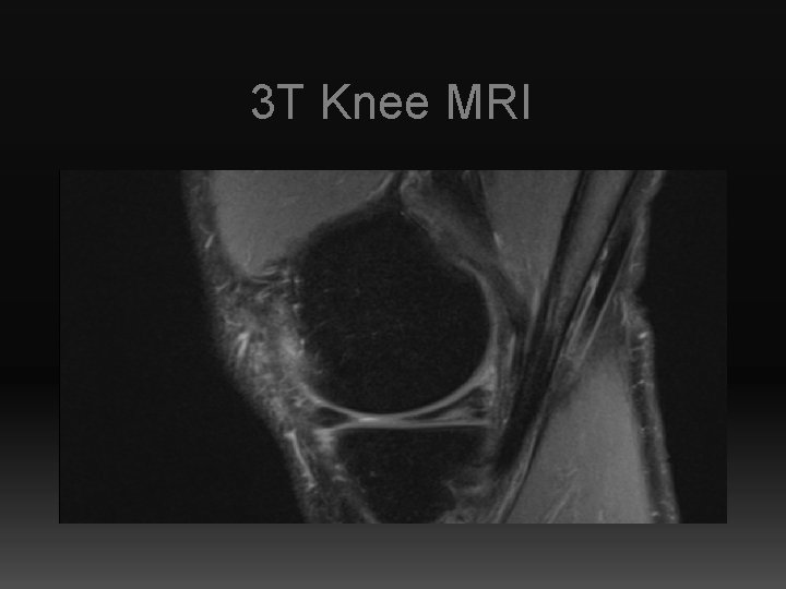 3 T Knee MRI 