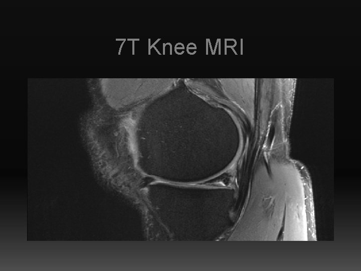 7 T Knee MRI 