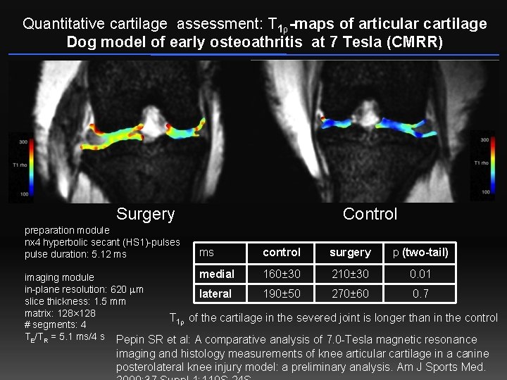 Quantitative cartilage assessment: T 1ρ -maps of articular cartilage Dog model of early osteoathritis