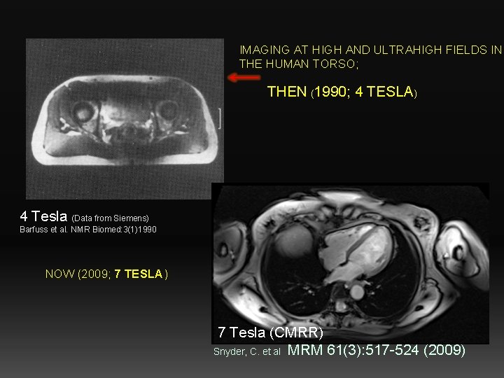 IMAGING AT HIGH AND ULTRAHIGH FIELDS IN THE HUMAN TORSO; THEN (1990; 4 TESLA)