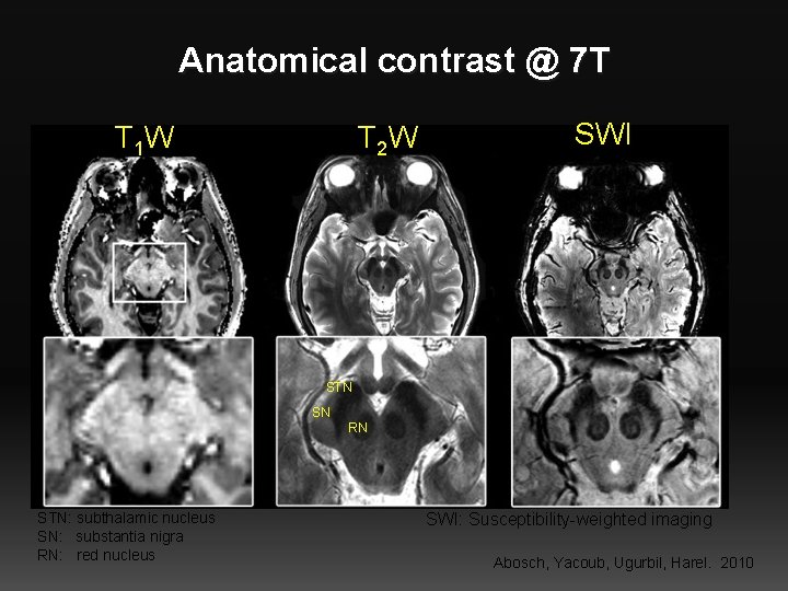 Anatomical contrast @ 7 T T 1 W T 2 W SWI STN SN