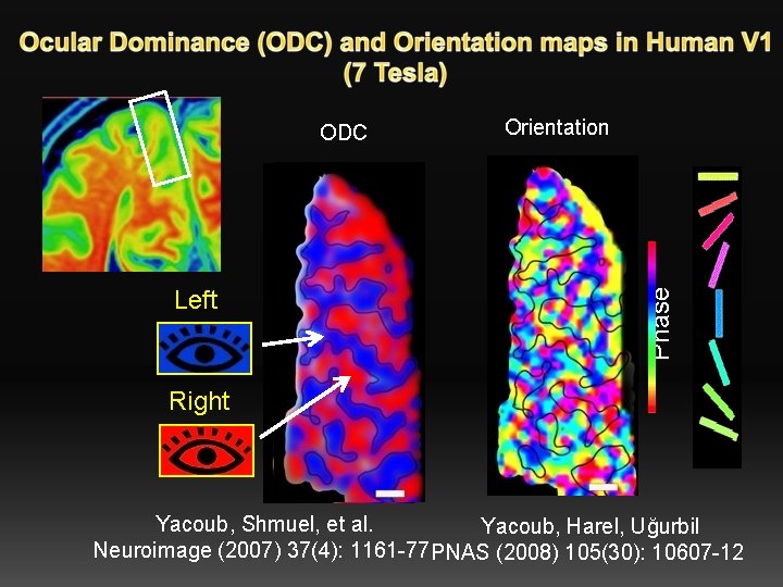 Orientation ODC Phase Left Right 1 mm Yacoub, Shmuel, et al. Yacoub, Harel, Uğurbil