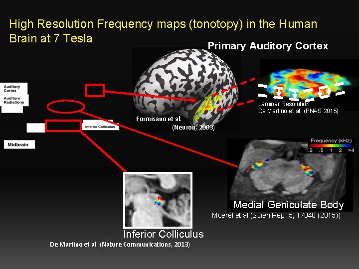 High Resolution Frequency maps (tonotopy) in the Human Brain at 7 Tesla Primary Auditory