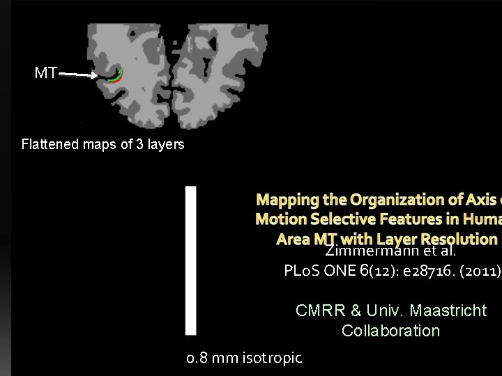 MT Flattened maps of 3 layers surface Zimmermann et al. PLo. S ONE 6(12):
