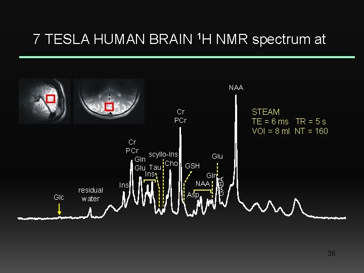 7 TESLA HUMAN BRAIN 1 H NMR spectrum at NAA STEAM TE = 6