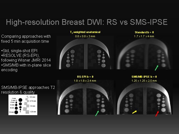 High-resolution Breast DWI: RS vs SMS-IPSE T 2 -weighted anatomical Comparing approaches with fixed