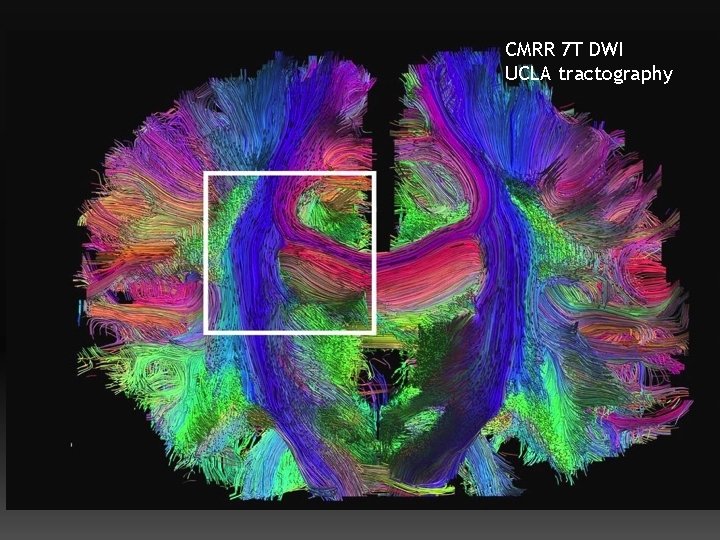 CMRR 7 T DWI UCLA tractography 54 