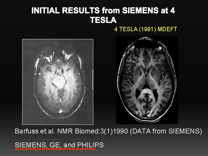 4 TESLA (1991) MDEFT Barfuss et. al. NMR Biomed: 3(1)1990 (DATA from SIEMENS) SIEMENS,