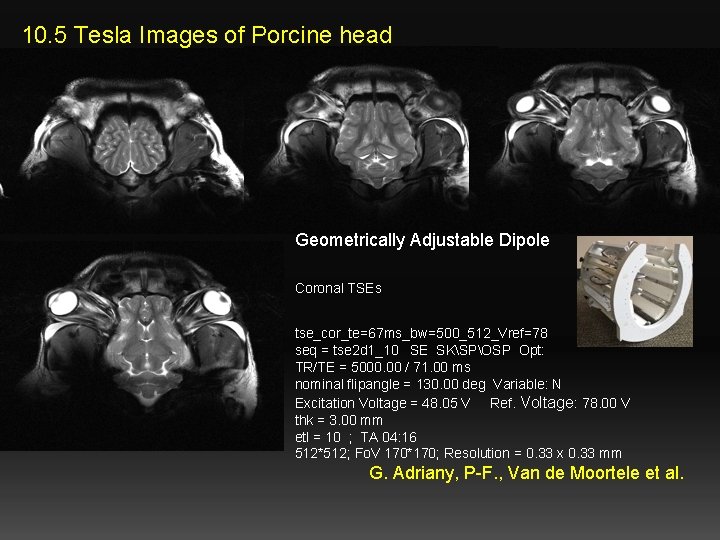 10. 5 Tesla Images of Porcine head Geometrically Adjustable Dipole Coronal TSEs tse_cor_te=67 ms_bw=500_512_Vref=78