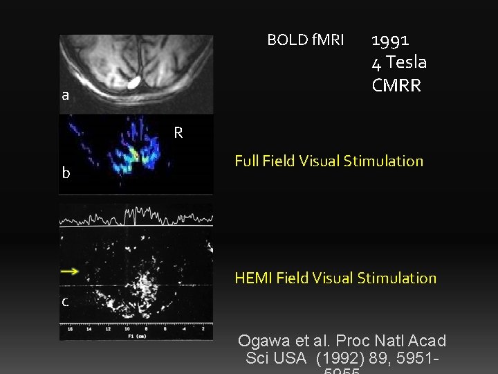 BOLD f. MRI a 1991 4 Tesla CMRR R b Full Field Visual Stimulation