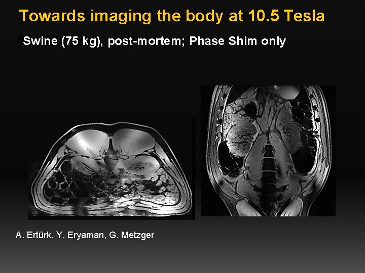 Towards imaging the body at 10. 5 Tesla Swine post-mortem Phase Shim only Swineimaging,