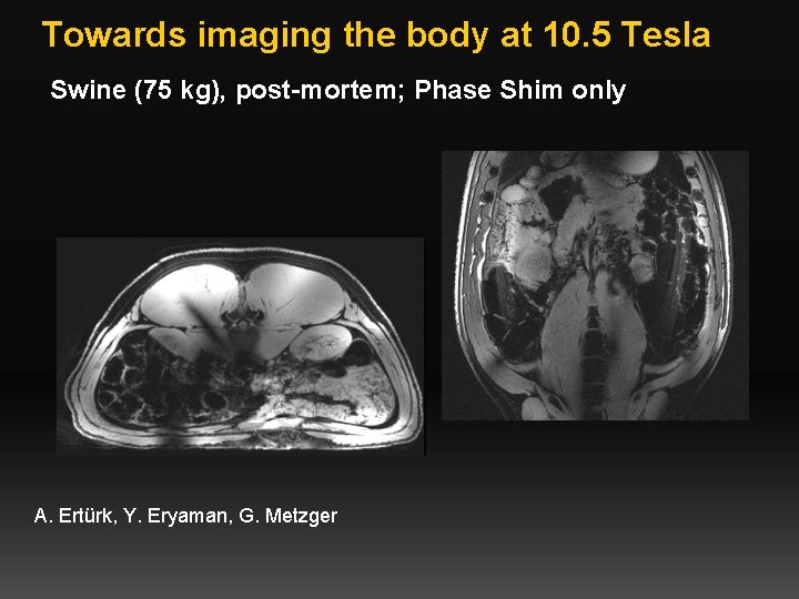 Towards imaging the body at 10. 5 Tesla Swine (75 kg), post-mortem; Phase Shim