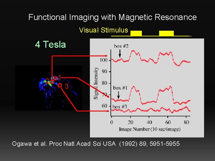 Functional Imaging with Magnetic Resonance Visual Stimulus 4 Tesla 2 1 3 Title Ogawa