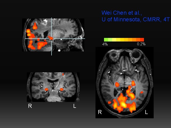 Wei Chen et al. , U of Minnesota, CMRR, 4 T 4% R L