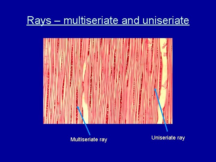 Rays – multiseriate and uniseriate Multiseriate ray Uniseriate ray 