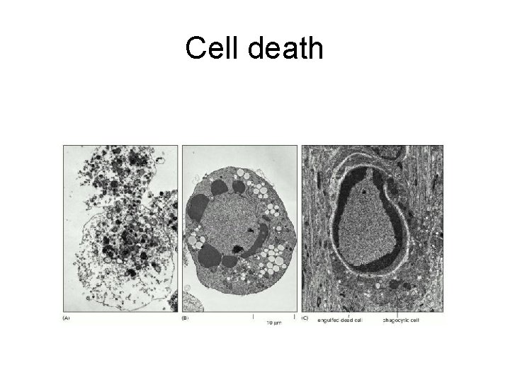 Cell death 