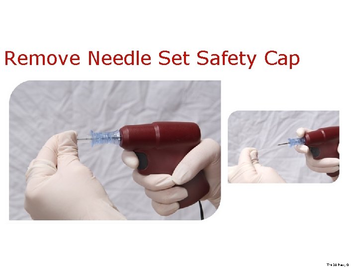 Remove Needle Set Safety Cap T-430 Rev, G 