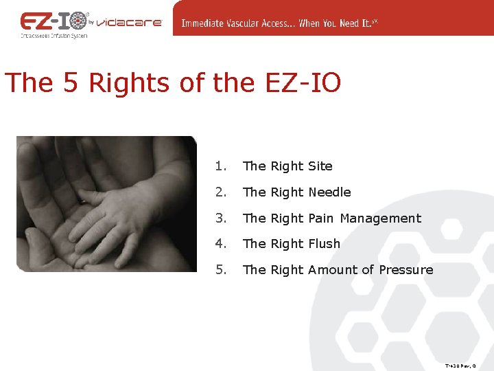 The 5 Rights of the EZ-IO 1. The Right Site 2. The Right Needle