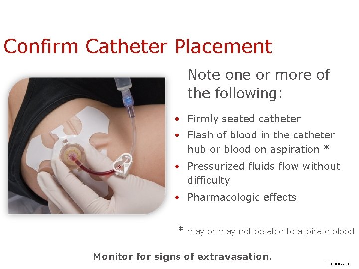 Confirm Catheter Placement Note one or more of the following: • Firmly seated catheter
