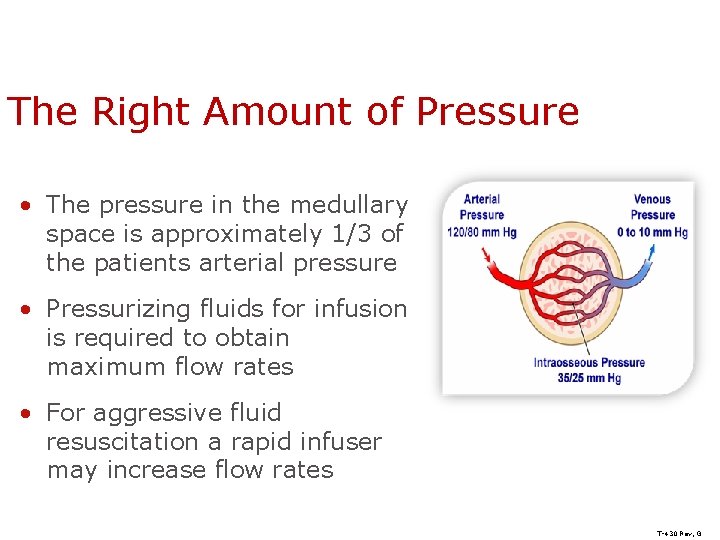 The Right Amount of Pressure • The pressure in the medullary space is approximately