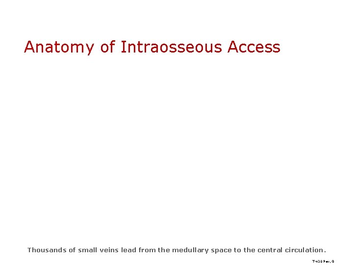 Anatomy of Intraosseous Access Thousands of small veins lead from the medullary space to