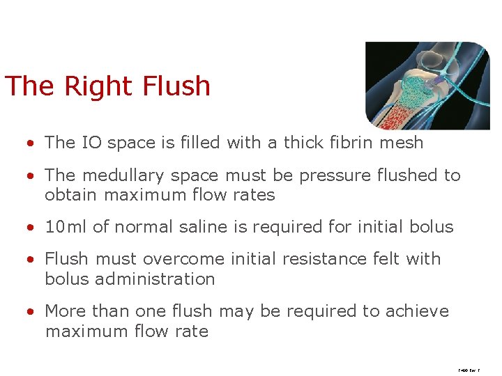 The Right Flush • The IO space is filled with a thick fibrin mesh