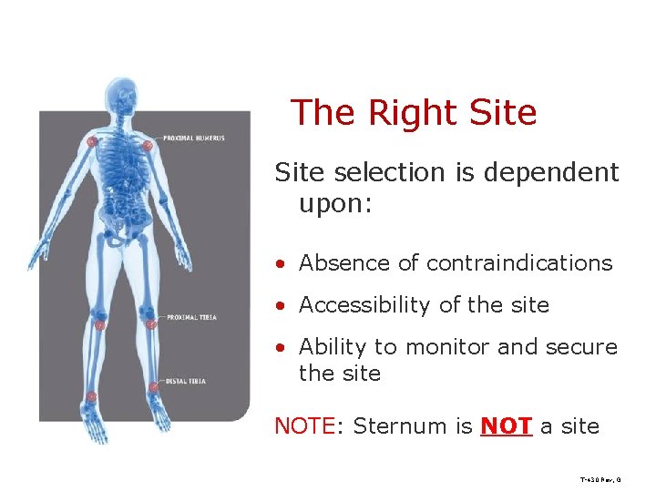 The Right Site selection is dependent upon: • Absence of contraindications • Accessibility of