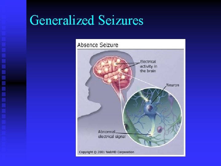 Generalized Seizures 