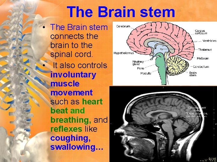 The Brain stem • The Brain stem connects the brain to the spinal cord.