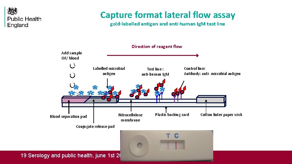 Capture format lateral flow assay gold-labelled antigen and anti-human Ig. M test line Direction