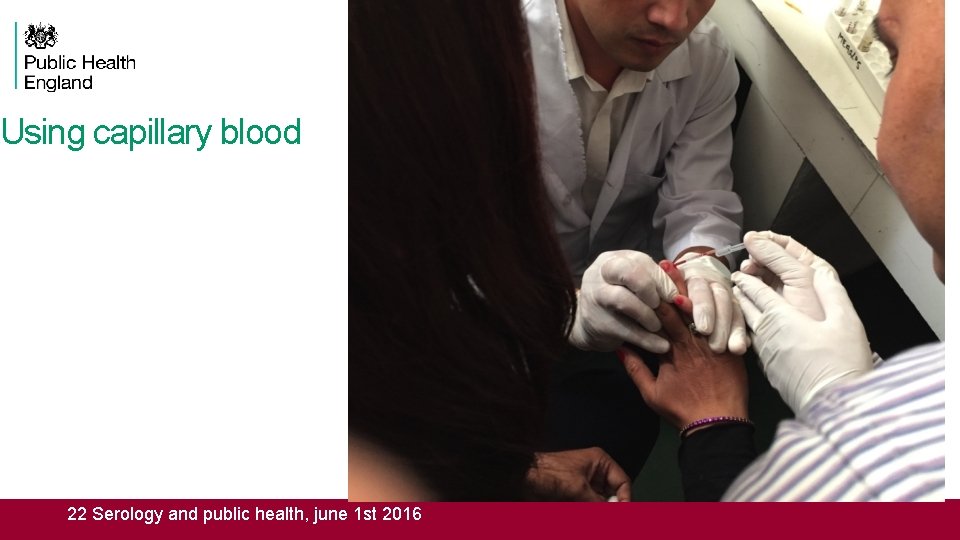 Using capillary blood 22 Serology and public health, june 1 st 2016 