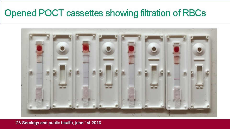 Opened POCT cassettes showing filtration of RBCs 23 Serology and public health, june 1