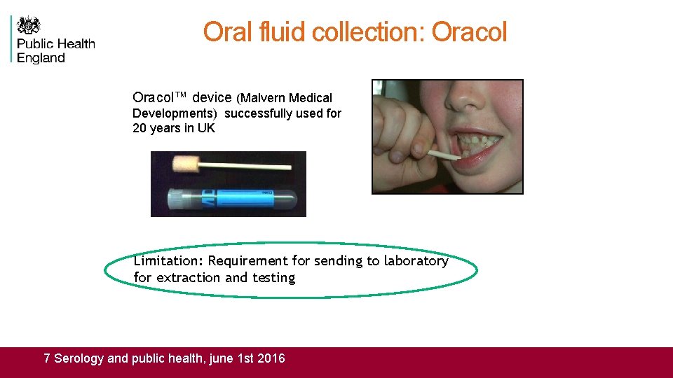 Oral fluid collection: Oracol™ device (Malvern Medical Developments) successfully used for 20 years in