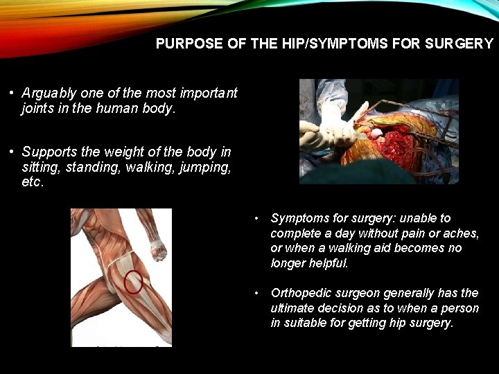 PURPOSE OF THE HIP/SYMPTOMS FOR SURGERY • Arguably one of the most important joints PURPOSE OF THE HIP/SYMPTOMS FOR SURGERY • Arguably one of the most important joints