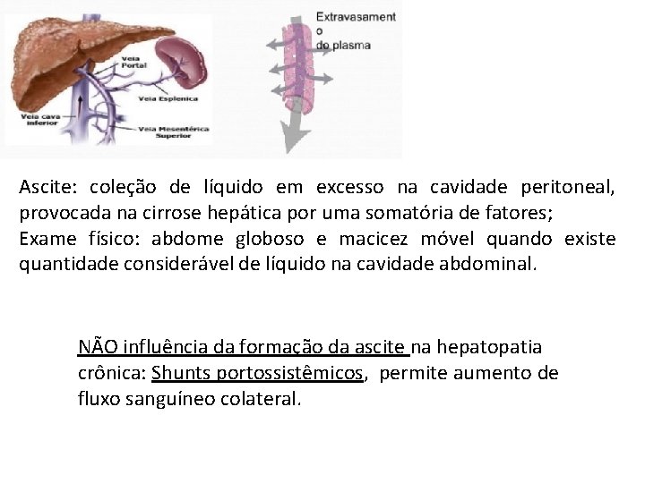 Ascite: coleção de líquido em excesso na cavidade peritoneal, provocada na cirrose hepática por
