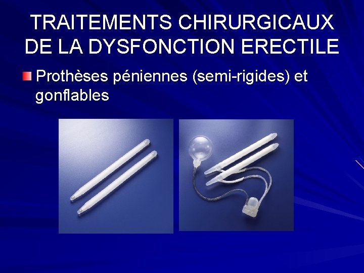 TRAITEMENTS CHIRURGICAUX DE LA DYSFONCTION ERECTILE Prothèses péniennes (semi-rigides) et gonflables 