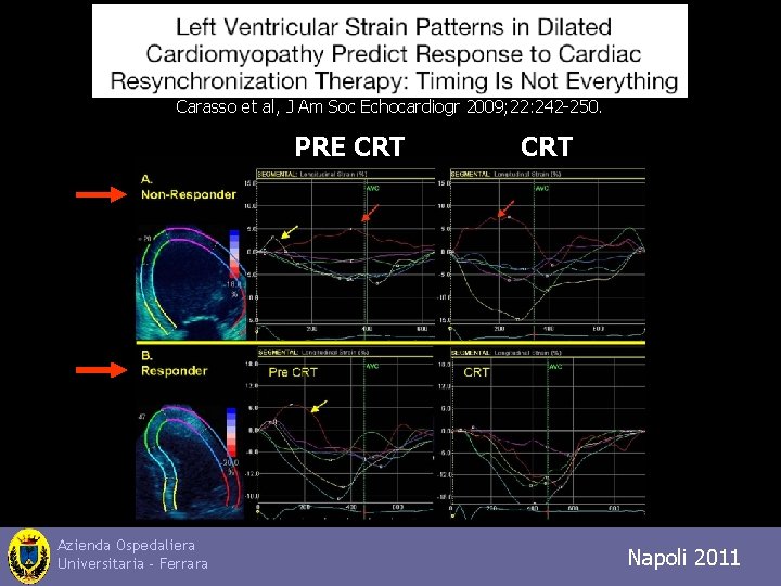 Carasso et al, J Am Soc Echocardiogr 2009; 22: 242 -250. PRE CRT Azienda