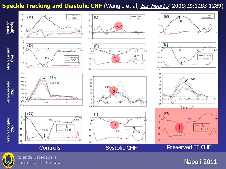 Strain Longitud. (%) Strain radiale (%) Strain Circonf. (%) Twist VS (gradi) Speckle Tracking